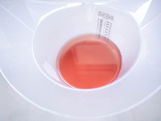 Red urine is caused by kidney stones