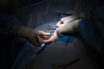 Breast tumor resection. Wound closure