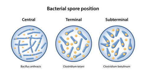 The position of bacillus spores: central, terminal, subterminal. The figure shows three locations of spore using examples of tetanus bacillus, botulism and anthrax. Vector illustration in flat style