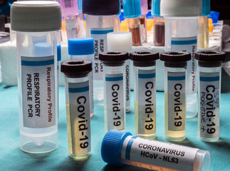 Vials containing samples from patients infected with covid19 coronavirus in a laboratory, Spain