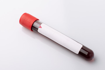 Blood sample with blank label on white table in the laboratory. Blood analysis