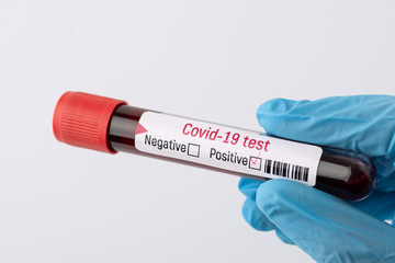 Fototapeta premium Nurse holding blood specimen with positive result on coronavirus, ready to tell sad news to the patient. Coronavirus global pandemic