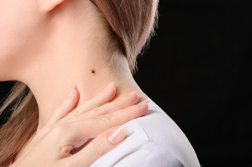 Mite crawling on the girl's neck. The concept of the need to examine the body during the period of tick activity.