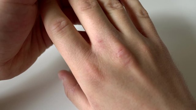 Checking hands for dry skin. Closeup of moving hands and reviewing them. Hands review for any dermatological problems. Inspecting for deviations on hands. Skin care.