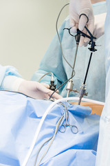 Surgeon performs laparoscopic surgery on the abdomen. Close-up of a laparoscope and doctor's hands