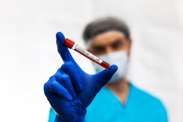 corona virus in lab scientist hold blood test new epidemic coronavirus ncov
