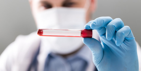 Man doctor with blood test tube in hands