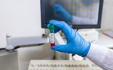 Pandemic COVID-19. Lab expert holding SARS-CoV-2 sample test tube. Laboratory diagnostic automated analyzer. Mirroring of hand in blue glove on computer monitor with medical software. Selective focus.