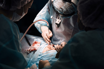 A shot of an emergency and a serious accident in the operating room, a team of surgeons makes an emergency operation to people in an accident. Saving lives, modern medetsina.