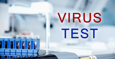 Biochemical laboratory conducts test of human and animal blood for 2019-ncov virus. Pandemic concept of Europe and world