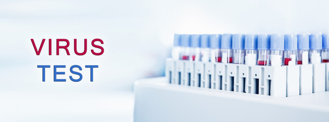 Biochemical laboratory test blood 2019-ncov virus . Pandemic vaccine coronavirus concept