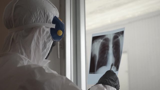 Doctor in protective suit, gloves, glasses and face mask examines an x-ray image of lungs during the coronavirus crisis.  the doctor studying the Patient's X-ray