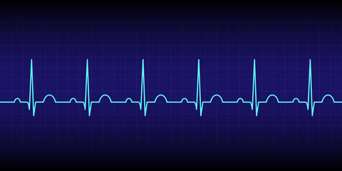 Electrocardiogram show normal heart beat line (Sinus rhythm) isolated on dark blue background.Vital sign.Medical healthcare concept.Vector.Illustration.