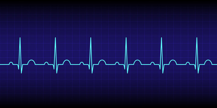 Electrocardiogram show normal heart beat line (Sinus rhythm) isolated on dark blue background.Vital sign.Medical healthcare concept.Vector.Illustration.
