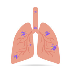 Virus and bacteria infected the human lungs illustration