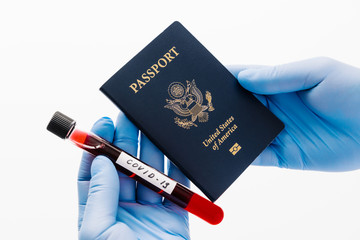 Fototapeta premium Hands in medical gloves hold blood sample for coronavirus and passport. Border control and quarantine for tourists. Postponed flight because of virus outbreak