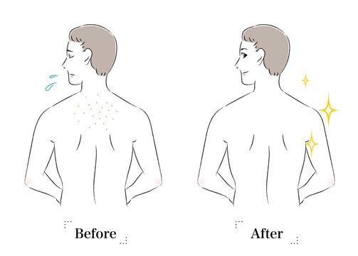 黒ずみ Photos Royalty Free Images Graphics Vectors Videos Adobe Stock