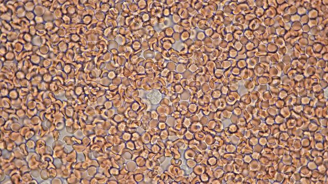 the movement of a macrophage (white blood cell) in a drop of blood under a microscope, plays an important role in protecting the body from pathogenic organisms 4K