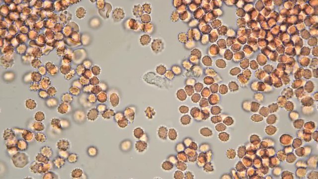 the movement of a macrophage (white blood cell) in a drop of blood under a microscope, plays an important role in protecting the body from pathogenic organisms 4K