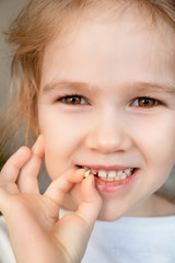 close up girl with fallen milk tooth in hand.