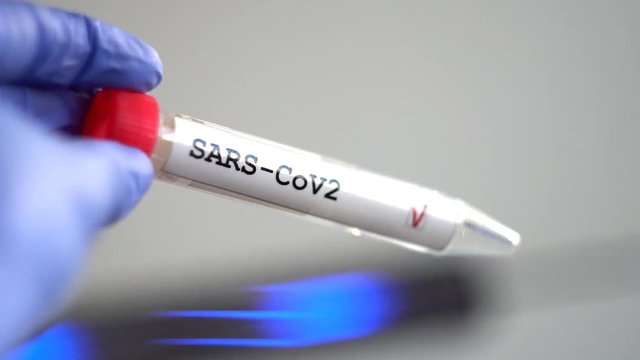 coronavirus test. Test tube lying on inspiratory protective respiratory mask. COVID-19 test or SARS-CoV-2 test. Stop spreading