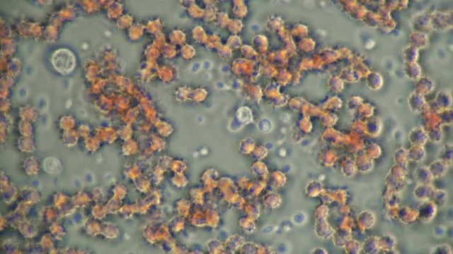 the movement of a macrophage (white blood cell) in a drop of blood under a microscope, plays an important role in protecting the body from pathogenic organisms 4K