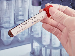 Fototapeta premium Coronavirus Blood Test. COVID-19 test Negative. Corona virus. Pa