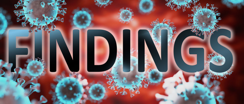 Covid And Findings, Pictured By Word Findings And Viruses To Symbolize That Findings Is Related To Corona Pandemic And That Epidemic Affects Findings A Lot, 3d Illustration