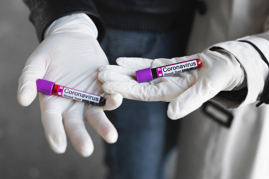 Man And Woman Wearing Mask Holding A Positive Blood Test Result For The New Rapidly Spreading Coronavirus. Laboratory Testing Patient Blood