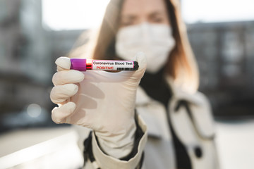 Wonan's hands holding a test tube with a blood sample for research new rapidly spreading Coronavirus Covid-19