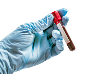 Test blood tubes vacuum hand holding