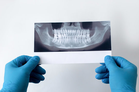dentist holds photo of teeth in his hands