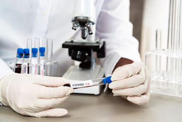 Positive COVID-19, SARS-COv2 test and laboratory sample of blood testing for diagnosis new Coronavirus infection..