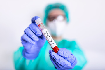 Coronavirus 2019-nCoV Blood Sample. New Epidemic Corona Virus. Corona virus outbreaking. Corona Virus in Lab. Scientist hold tube with Blood Test with the Virus Name Coronavirus. vaccine