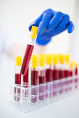 A woman's hand in a blue glove holding a blood sample in a laboratory test tube to detect viruses