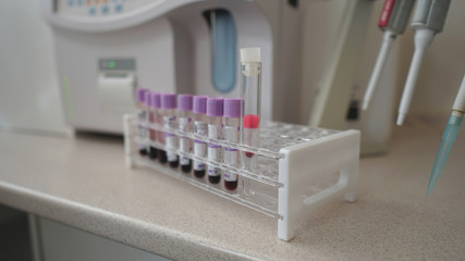Set of test tubes close-up in plastic box holder. Coronavirus epidemic