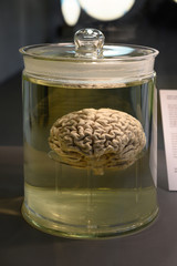 Gehirn im Glas