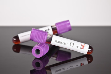 santé coronavirus covid-19 épidémie pandémie