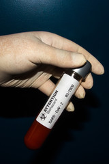 Naklejka premium Biohazard test of coronavirus