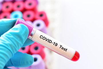 Obraz premium Test tube with blood sample for COVID-19 test