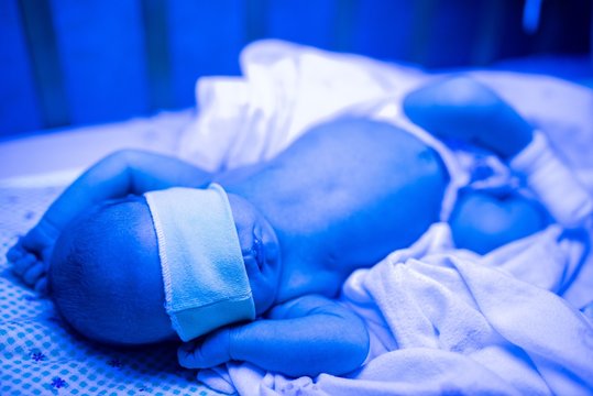 Newborn having a treatment for jaundice under ultraviolet light, Baby has high level of bilirubin, laying under blue light to reduce jaundice level. Safe medical procedures