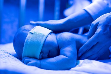 Newborn having a treatment for jaundice under ultraviolet light, Baby has high level of bilirubin, laying under blue light to reduce jaundice level. Safe medical procedures