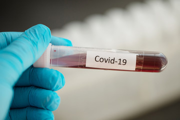 Fototapeta premium Test tube with blood sample for COVID-19 test, novel coronavirus 2019 found in Wuhan, China.