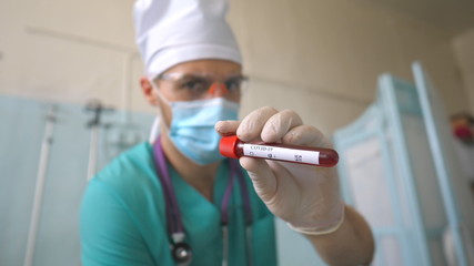 Scientist holding test tube with blood sample to coronavirus. Arm of laboratory worker with...