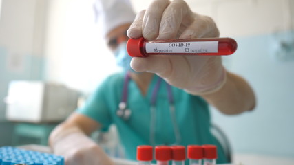 Scientist holding test tube with blood sample to coronavirus. Arm of laboratory worker with protective gloves testing blood samples on clinic. Concept of health and safety life from COVID-19 pandemic