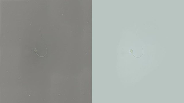 Human sperm under a microscope (spermatozoa), consists of sperm and seminal fluid, also contains various substances: antibodies, cholesterol, choline, citric acid, fructose and DNA ..., one sperm with