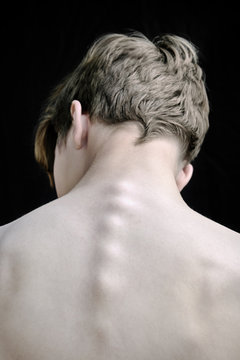 Rear view of teenage boy with spine
