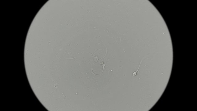 Human sperm under a microscope (spermatozoa), consists of sperm and seminal fluid, also contains various substances: antibodies, cholesterol, choline, citric acid, fructose and DNA ...