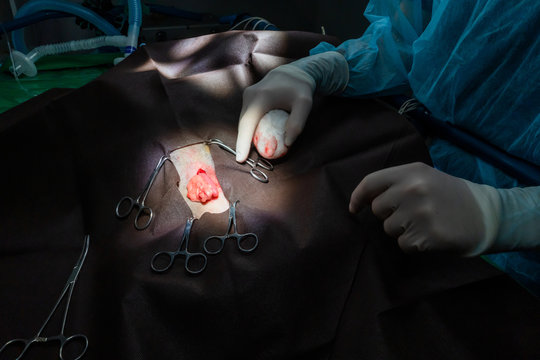 Detail Of A Surgery.