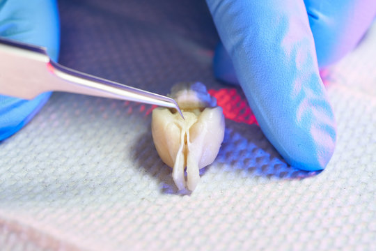 curved forceps used to dissect rat brain